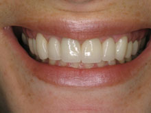 After image