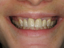 Before image