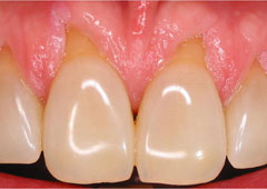 Before image