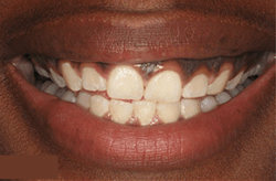 Before image