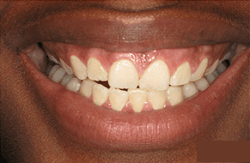 After image