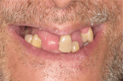 Before image